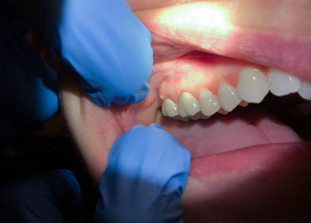 Best Pediatric Emergency Dentist in Spring Green, WI